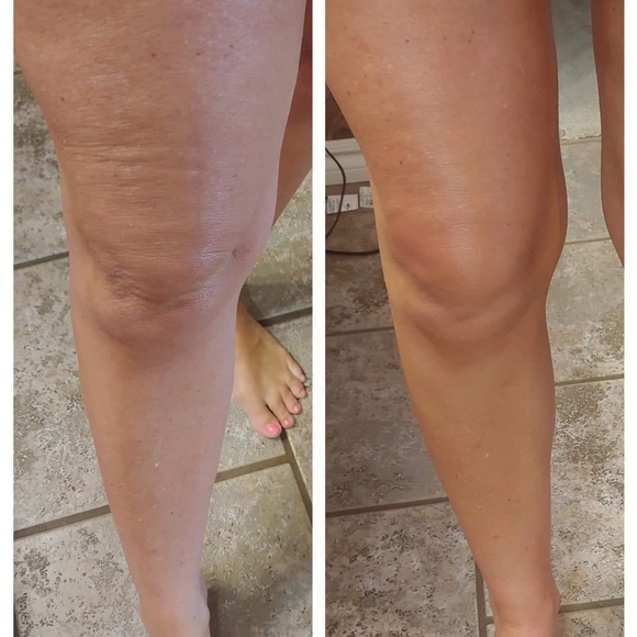 NUSKIN AGELOC HONEY & HIBISCUS CELLULITE LOTION 💋 Lot of 2 tubes - Picture 7 of 7